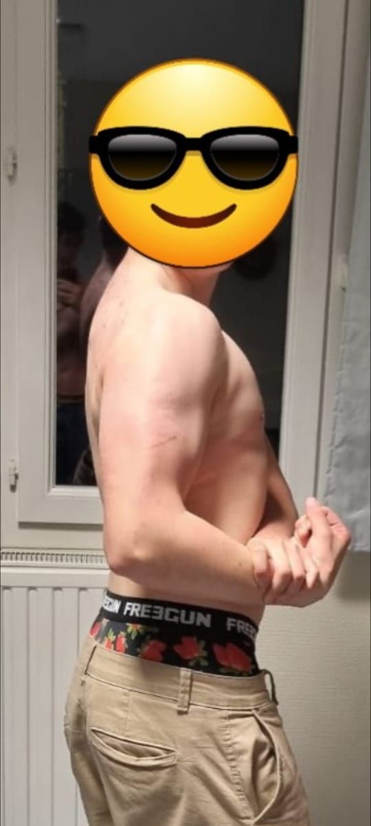 Perfil de Gurkan